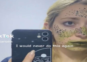 Il tentativo di una donna di realizzare lentiggini finte con l'henné finisce in un disastro