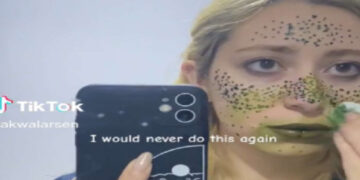 Il tentativo di una donna di realizzare lentiggini finte con l'henné finisce in un disastro