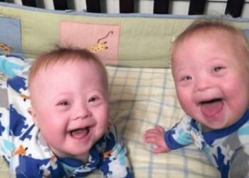 Nonostante abbia dato alla luce due gemelli rarissimi, la madre 46enne è felice della sua decisione