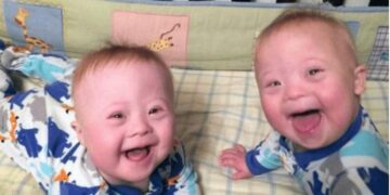 Nonostante abbia dato alla luce due gemelli rarissimi, la madre 46enne è felice della sua decisione