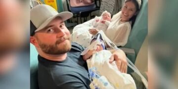 Dopo 134 giorni, i genitori tengono per la prima volta le gemelle siamesi separate